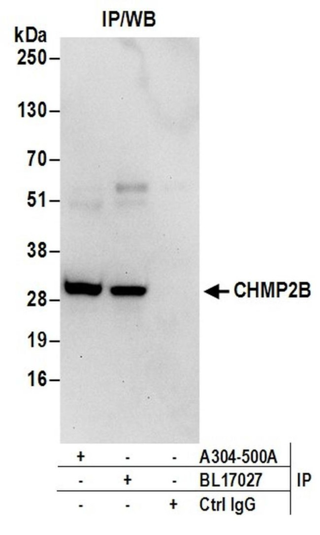 CHMP2B Antibody in Immunoprecipitation (IP)