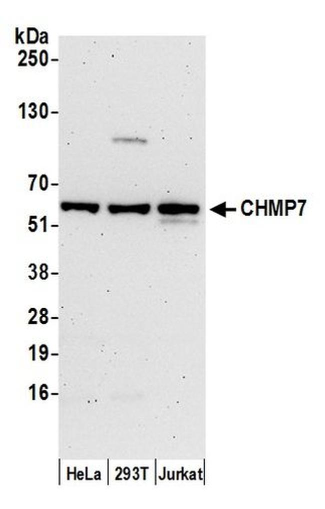 CHMP7 Antibody in Western Blot (WB)