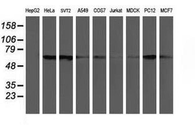 CHN1 Antibody in Western Blot (WB)