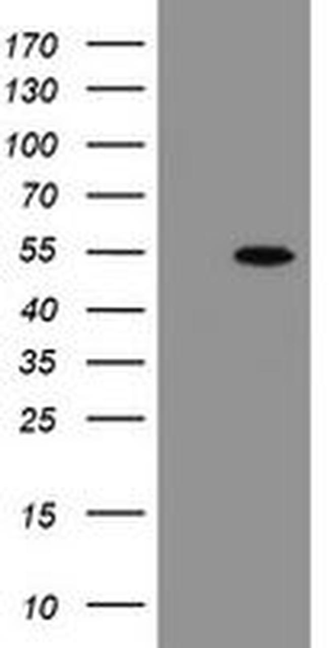 CHN1 Antibody in Western Blot (WB)