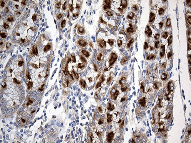 CHP1 Antibody in Immunohistochemistry (Paraffin) (IHC (P))