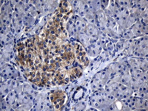 CHP1 Antibody in Immunohistochemistry (Paraffin) (IHC (P))