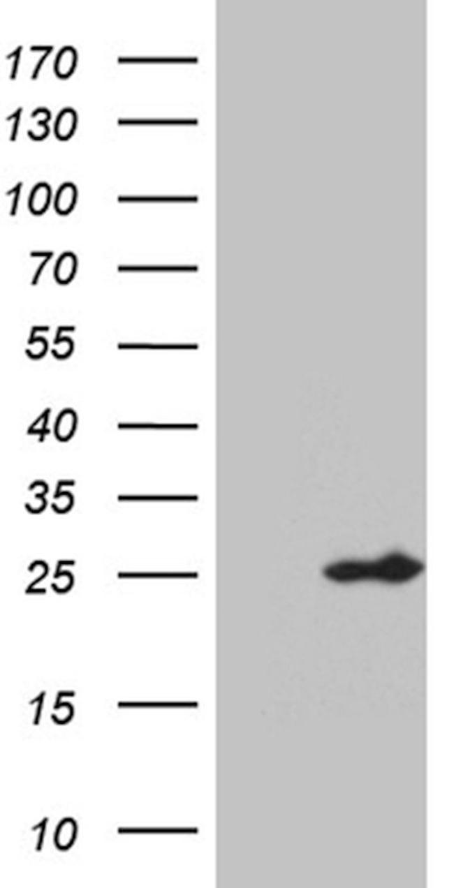 CHP1 Antibody in Western Blot (WB)