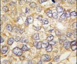 Chordin Antibody in Immunohistochemistry (IHC)