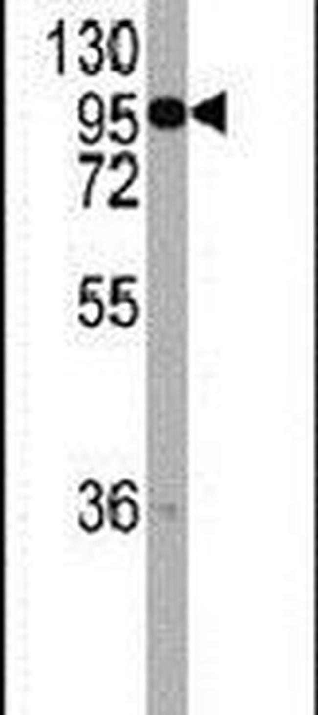 Chordin Antibody in Western Blot (WB)