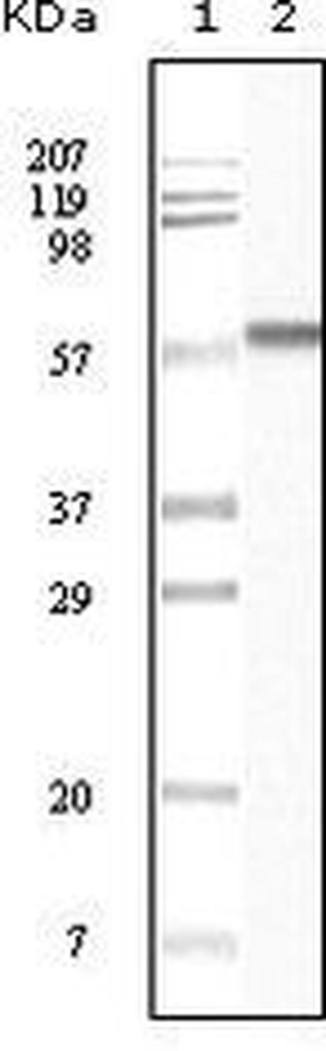 CK1 alpha Antibody in Western Blot (WB)