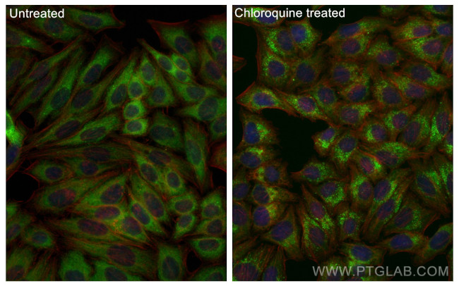 GABARAPL1 Antibody in Immunocytochemistry (ICC/IF)