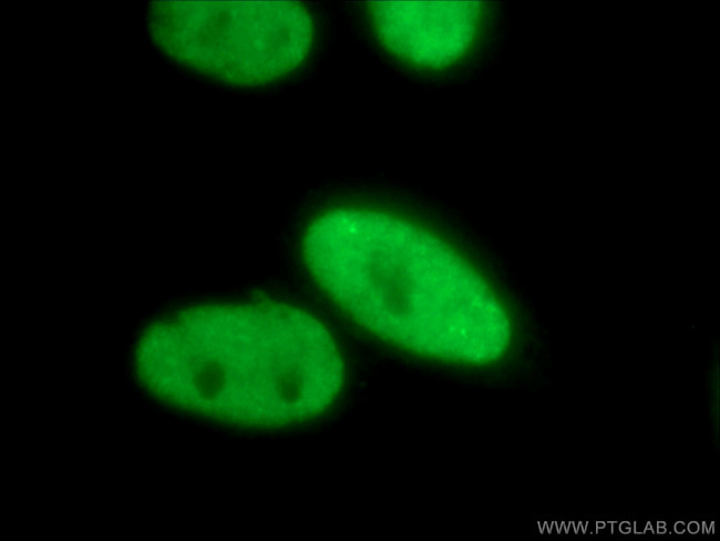 FUS/TLS Antibody in Immunocytochemistry (ICC/IF)