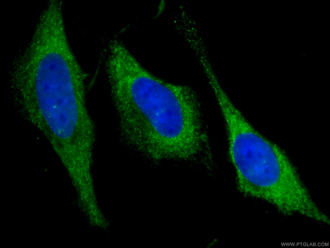 GDI2 Antibody in Immunocytochemistry (ICC/IF)