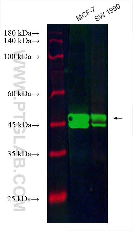 ESR2 Antibody in Western Blot (WB)