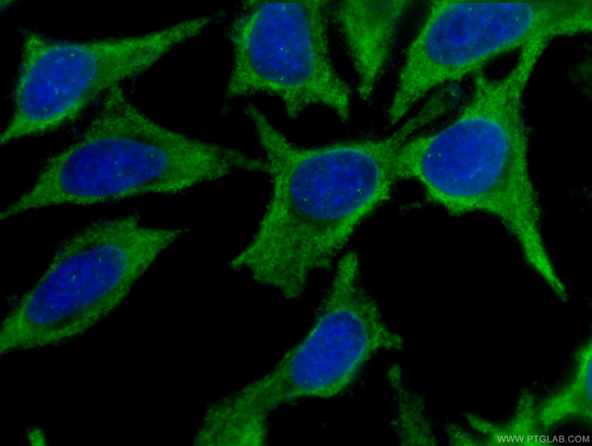 Cytoglobin Antibody in Immunocytochemistry (ICC/IF)