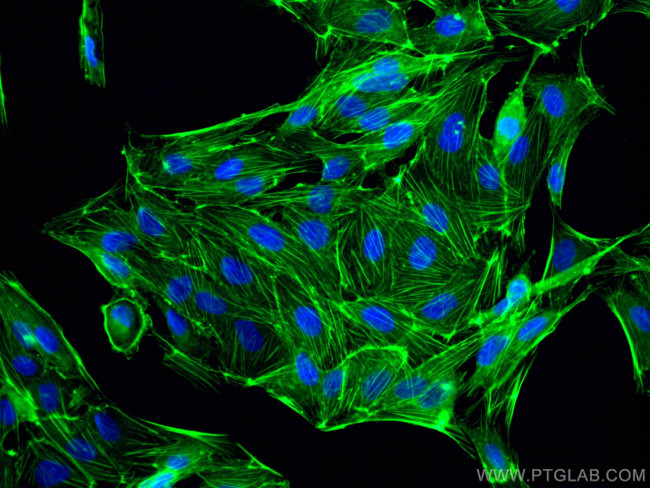 beta Actin Antibody in Immunocytochemistry (ICC/IF)