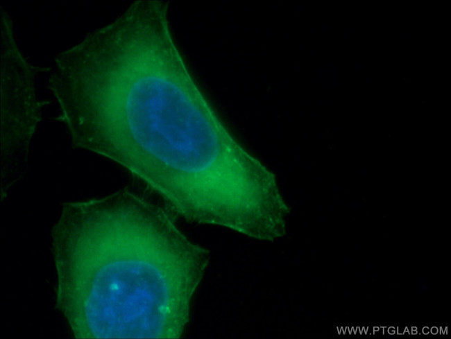 beta Actin Antibody in Immunocytochemistry (ICC/IF)