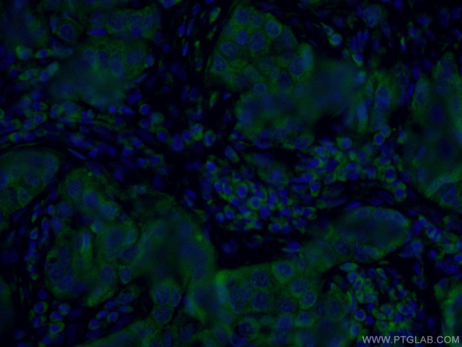 PADI2 Antibody in Immunohistochemistry (PFA fixed) (IHC (PFA))