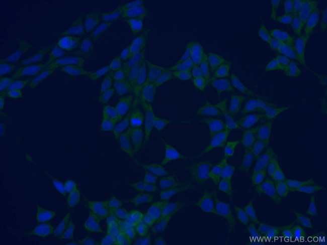 PDIA3 Antibody in Immunocytochemistry (ICC/IF)