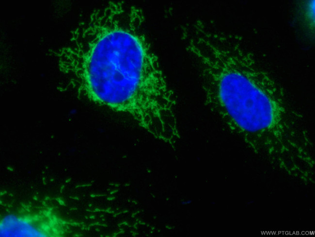 SOD2 Antibody in Immunocytochemistry (ICC/IF)