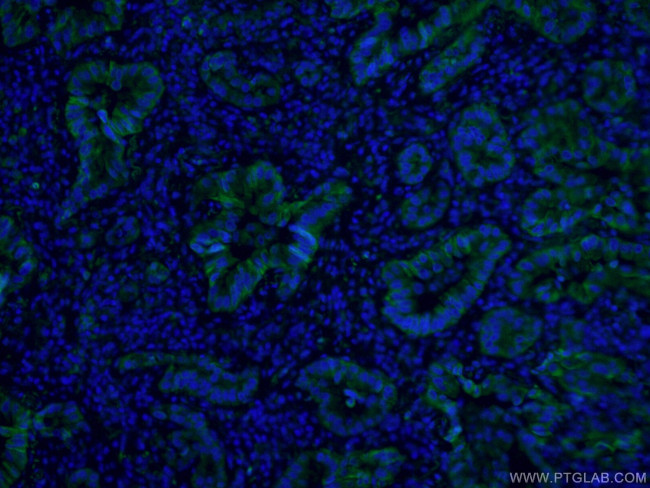 Cytokeratin 7 Antibody in Immunohistochemistry (PFA fixed) (IHC (PFA))