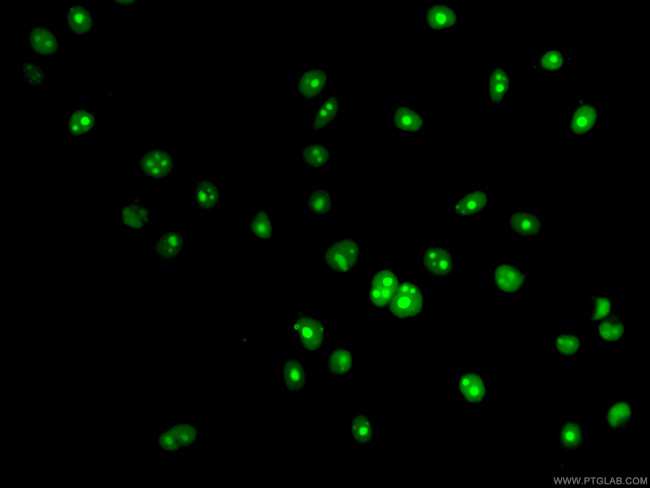 NSUN2 Antibody in Immunocytochemistry (ICC/IF)