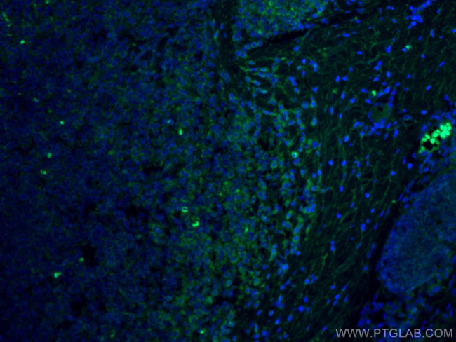 FYN Antibody in Immunohistochemistry (PFA fixed) (IHC (PFA))