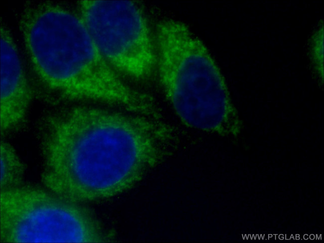 FIS1 Antibody in Immunocytochemistry (ICC/IF)