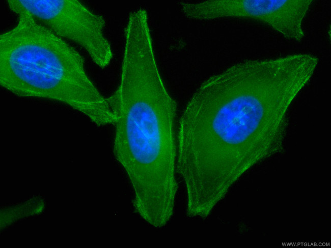 CALD1 Antibody in Immunocytochemistry (ICC/IF)