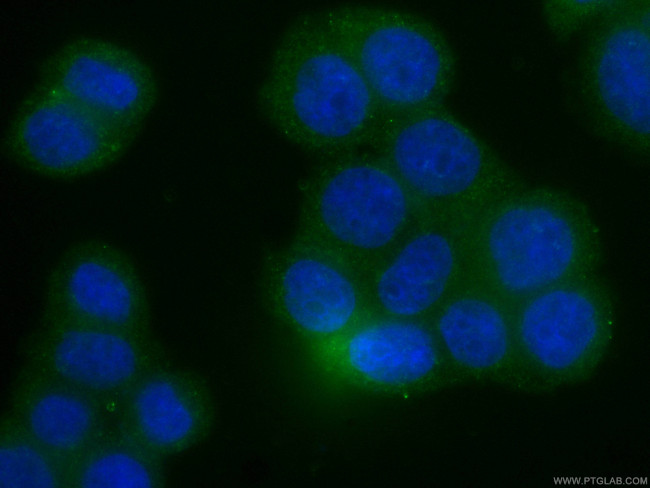 RHOA Antibody in Immunocytochemistry (ICC/IF)