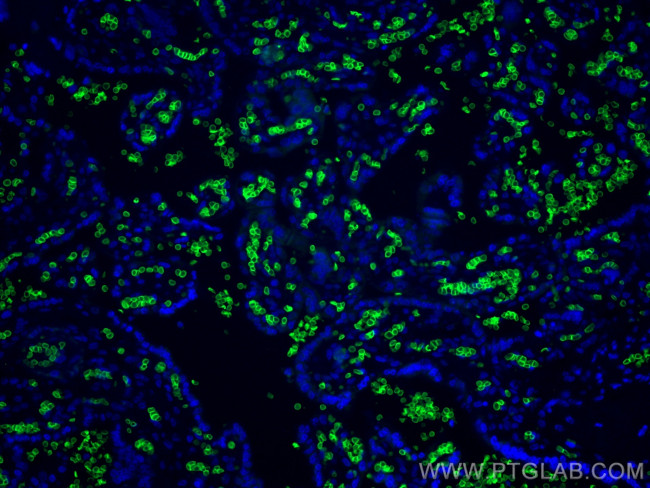 band 3/AE1 Antibody in Immunohistochemistry (PFA fixed) (IHC (PFA))