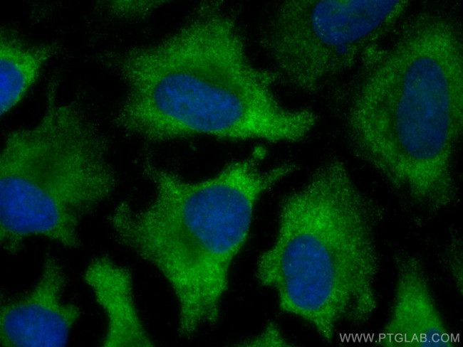 ACC Antibody in Immunocytochemistry (ICC/IF)