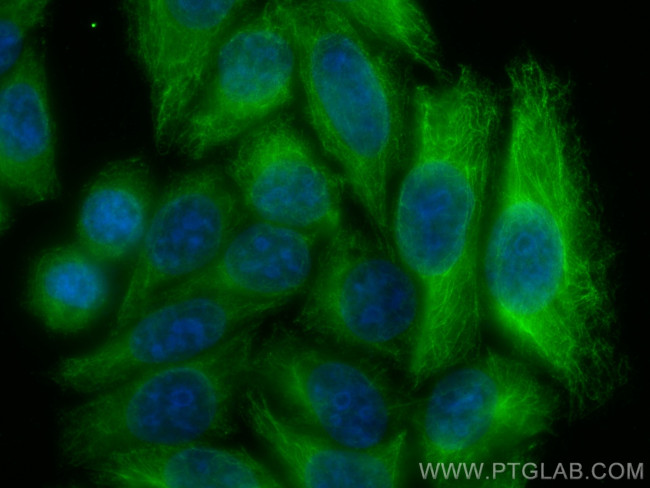 GSDMB Antibody in Immunocytochemistry (ICC/IF)