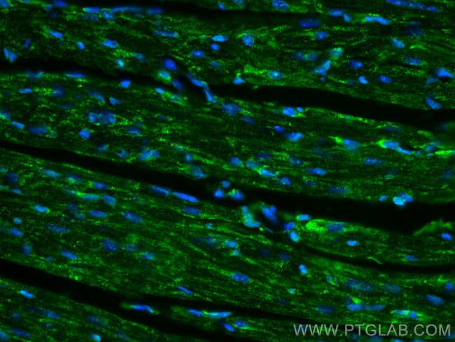 PARK2/Parkin Antibody in Immunohistochemistry (Paraffin) (IHC (P))