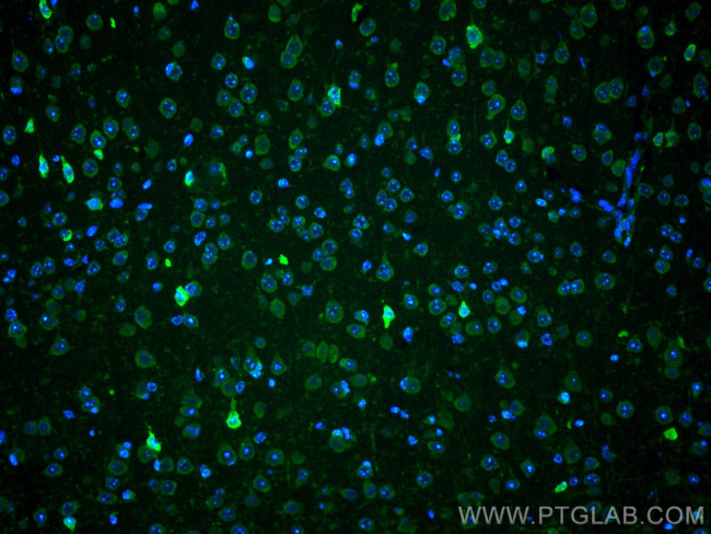 PARK2/Parkin Antibody in Immunohistochemistry (Paraffin) (IHC (P))