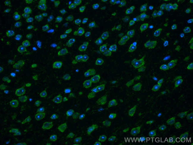 PARK2/Parkin Antibody in Immunohistochemistry (Paraffin) (IHC (P))