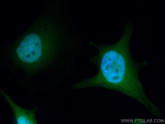 Thymidylate synthase Antibody in Immunocytochemistry (ICC/IF)