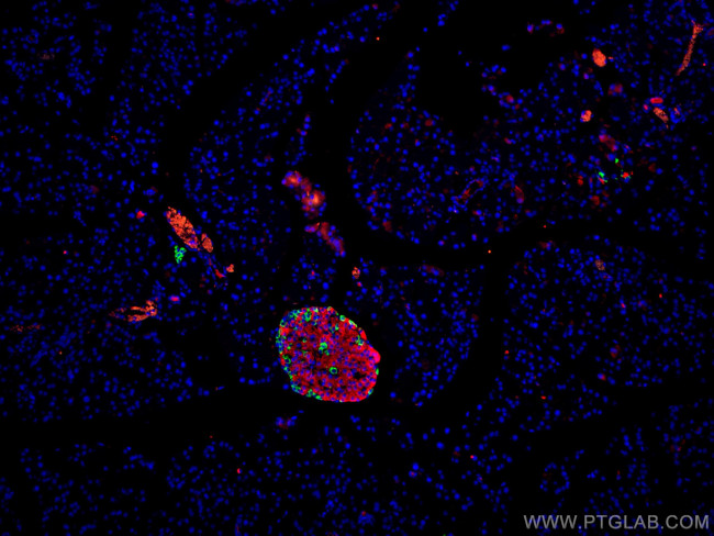 Glucagon Antibody in Immunohistochemistry (Paraffin) (IHC (P))