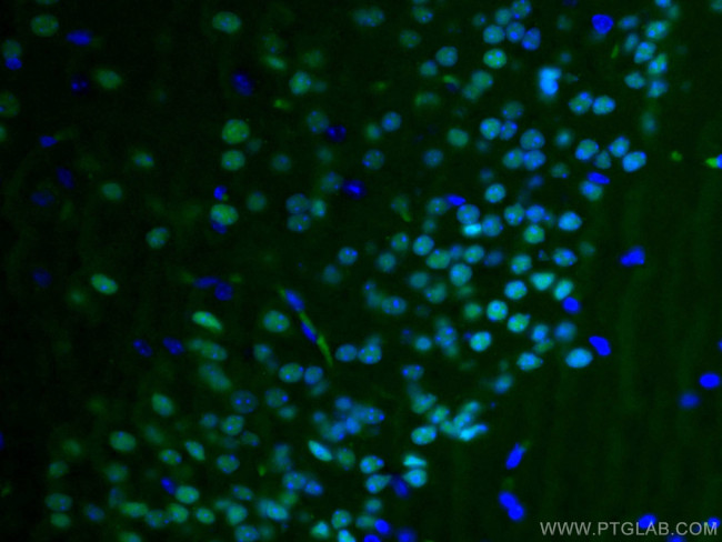 TBR1 Antibody in Immunohistochemistry (Paraffin) (IHC (P))