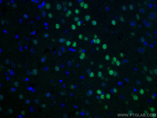 TBR1 Antibody in Immunohistochemistry (Paraffin) (IHC (P))