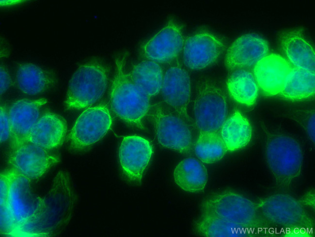 Cytokeratin 20 Antibody in Immunocytochemistry (ICC/IF)