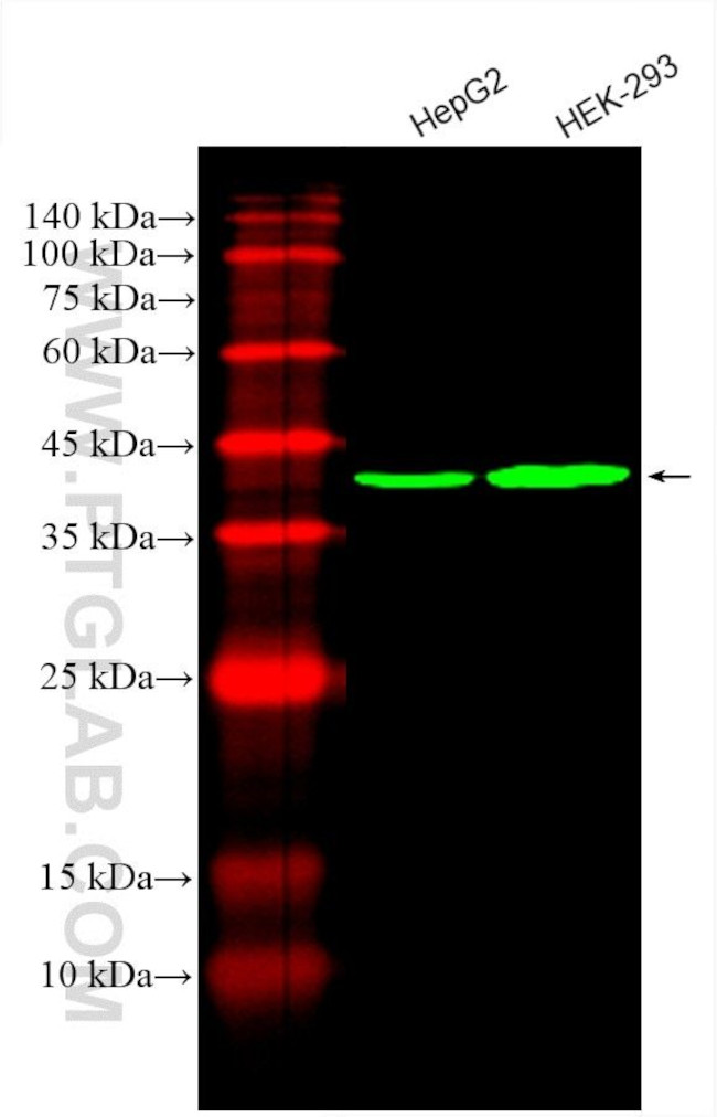 PDH E1 Alpha Antibody in Western Blot (WB)
