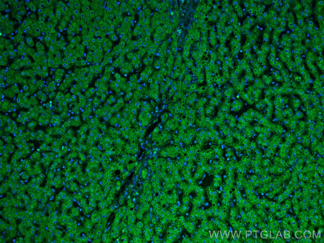 Plasminogen Antibody in Immunohistochemistry (Paraffin) (IHC (P))