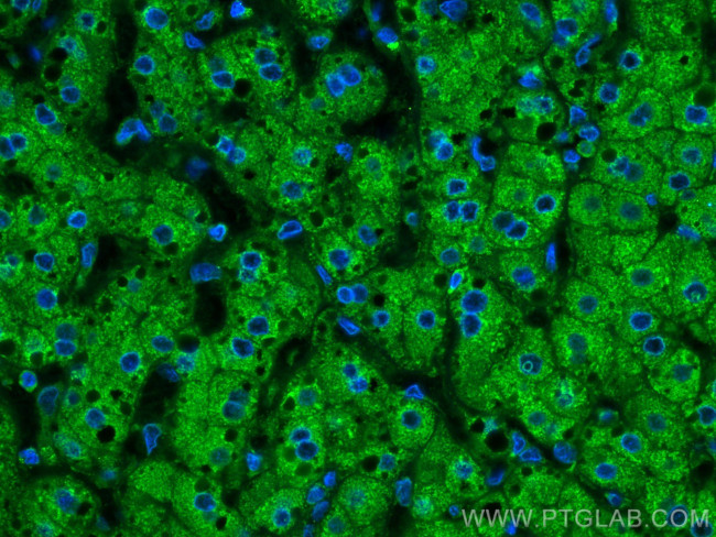 Plasminogen Antibody in Immunohistochemistry (Paraffin) (IHC (P))