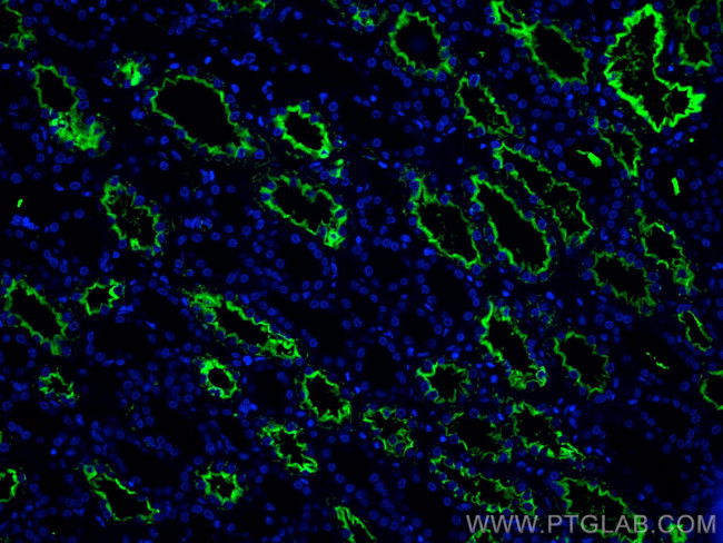 AQP1 Antibody in Immunohistochemistry (Paraffin) (IHC (P))