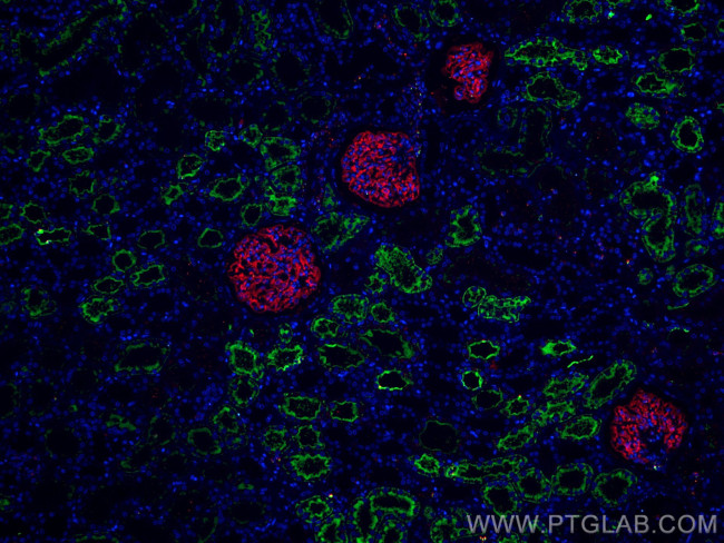 AQP1 Antibody in Immunohistochemistry (Paraffin) (IHC (P))