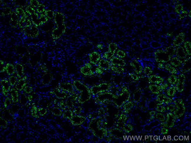 LGMN Antibody in Immunohistochemistry (Paraffin) (IHC (P))