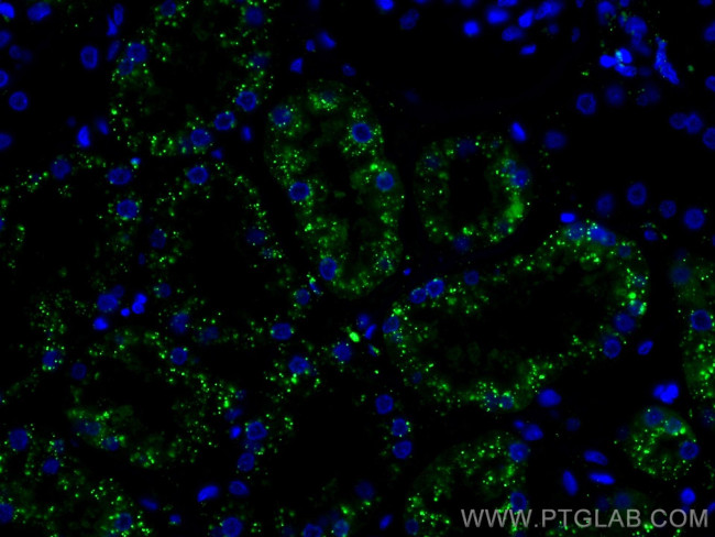 LGMN Antibody in Immunohistochemistry (Paraffin) (IHC (P))