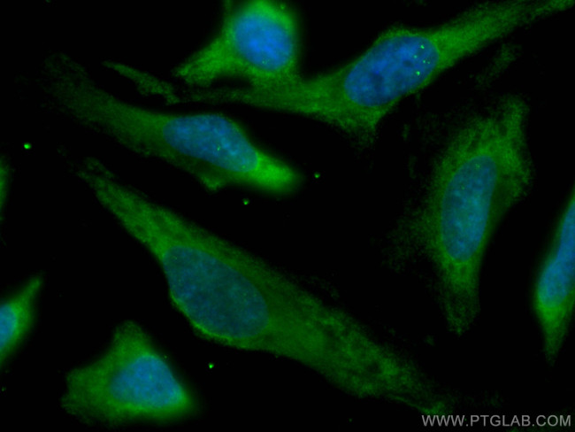 ATG7 Antibody in Immunocytochemistry (ICC/IF)