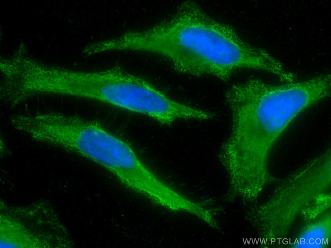 ALDH9A1 Antibody in Immunocytochemistry (ICC/IF)