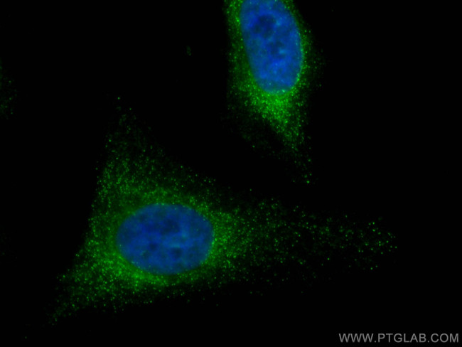 HPRT1 Antibody in Immunocytochemistry (ICC/IF)