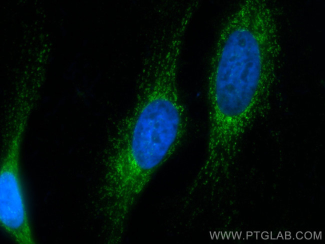 HADHB Antibody in Immunocytochemistry (ICC/IF)