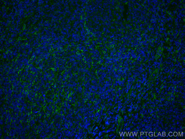 TMEM173/STING Antibody in Immunohistochemistry (Paraffin) (IHC (P))