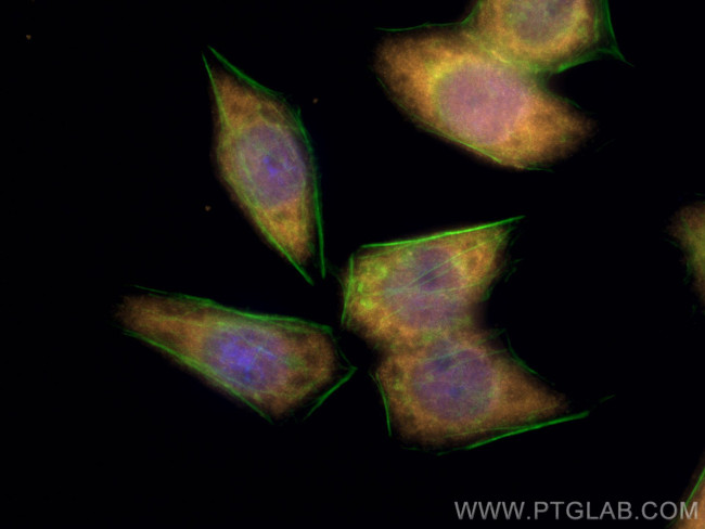 S100A11 Antibody in Immunocytochemistry (ICC/IF)